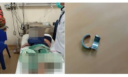 別亂套!少年GG套戒指卡死,消防出動才脫險!