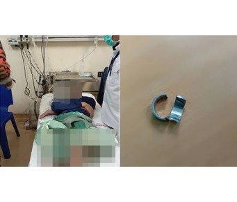 ややこしいことになるな!少年が“アレ”に指輪をはめて動かなくなり、消防が出動して事なきを得た!